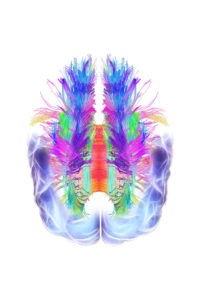 White matter fibres overlaid a 3d model of the human brain in top view. Coloured 3D diffusion spectral imaging (DSI) scan of the bundles of white matter nerve fibres in the brain. The fibres transmit nerve signals between brain regions and between the brain and the spinal cord. Diffusion spectrum imaging (DSI) is a variant of magnetic resonance imaging (MRI) in which a magnetic field maps the water contained in neuron fibers, thus mapping their criss-crossing patterns. A similar technique called diffusion tensor imaging (DTI) is also used to explore neural data of white matter fibres in the brain. Both methods allow mapping of their orientations and the connections between brain regions. Data/software: NIH Human Connectome Project / www.humanconnectomeproject.org).
